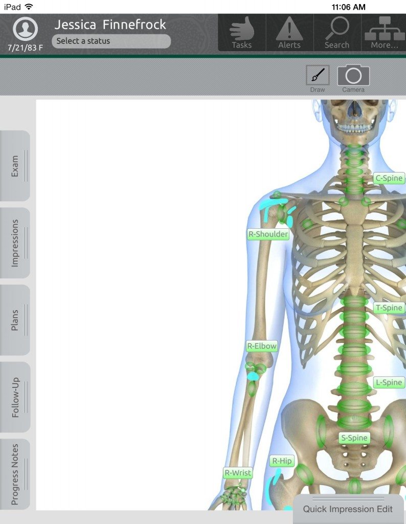 ortho extract software ortho extract software