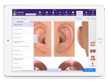 selecting impressions in EMA for otolaryngology on iPad