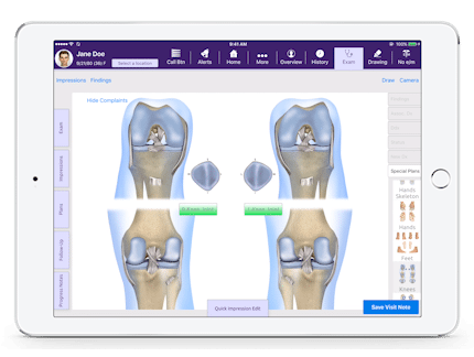3d knees joint diagram in EMA's interactive anatomical atlas for orthopedics