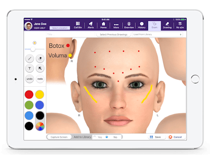 drawing Botox injection points on 3d face diagram in EMA for plastic surgery