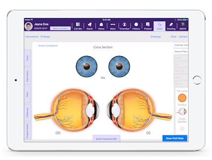 a cross section of left and right eyes in Interactive Anatomical Atlas, a feature of EMA, an ophthalmology software