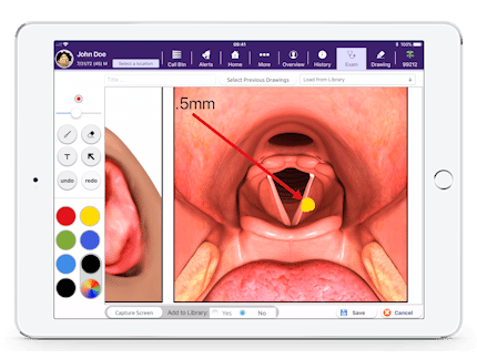 Drawing Board in EMA on iPad showing larynx