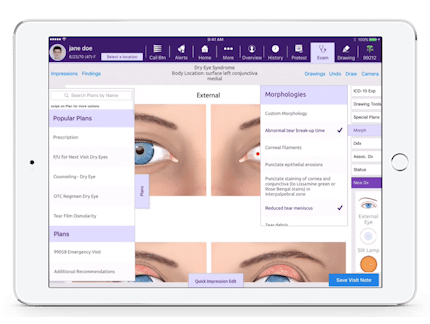 selecting plans and morphologies in EMA, an iPad-based ophthalmology EHR software