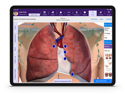 Images of anatomical atlas showing human lungs within allergy-specific software