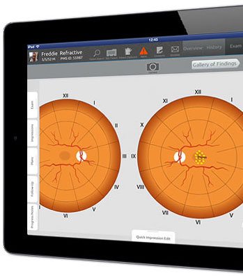 ophthalmology image on iPad EHR
