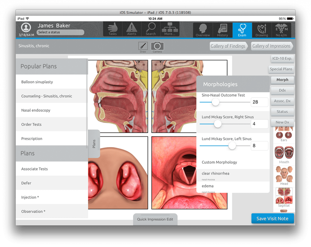 ENT_CE-TouchBased_Mobile