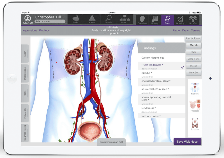 EMA_Urology