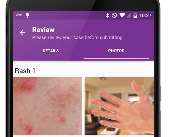telemedicine-dermatology-modernizing-medicine