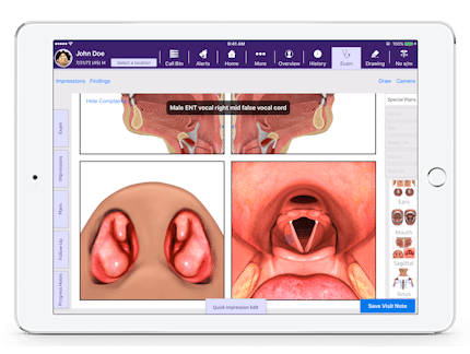 male ENT vocal right and mid false vocal chord 3d diagram in EMA Interactive Anatomical Atlas