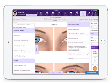 selecting plans and morphologies in EMA for ophthalmology