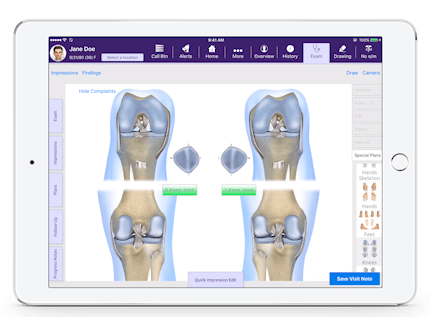 3d knees joint diagram in EMA's interactive anatomical atlas for orthopedics