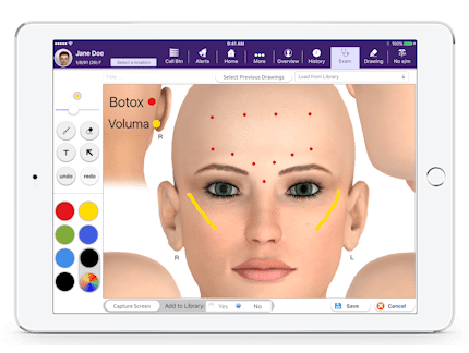drawing Botox injection points on 3d face diagram in EMA for plastic surgery