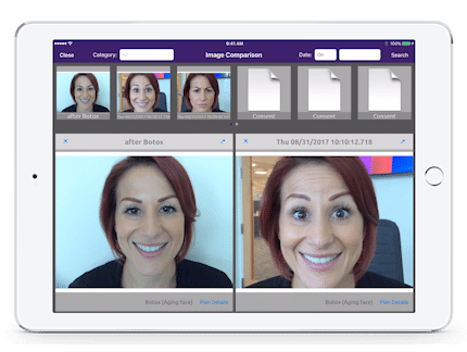 iPad integrated photography for botox aging face in EMA for plastic surgery