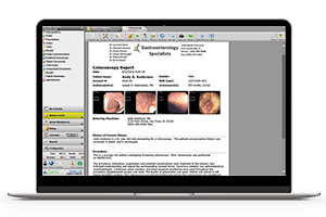 colonoscopy report in gMed endoscopy report writer on laptop