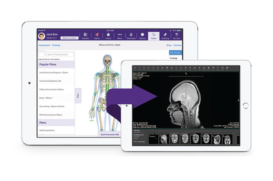 EMA EMR system for orthopedics in iPad linking out to PACS viewer with MR brain image