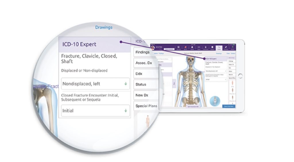 ICD-10 expert feature in EMA suggesting coding documentation for clavicle fracture