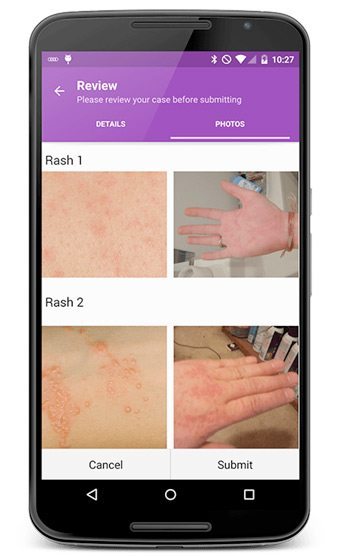 photos of patient rash in modmed telehealth app on android photos of patient rash in modmed telehealth app on android