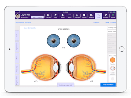 a cross section of left and right eyes in Interactive Anatomical Atlas, a feature of EMA, an ophthalmology software a cross section of left and right eyes in Interactive Anatomical Atlas, a feature of EMA, an ophthalmology software