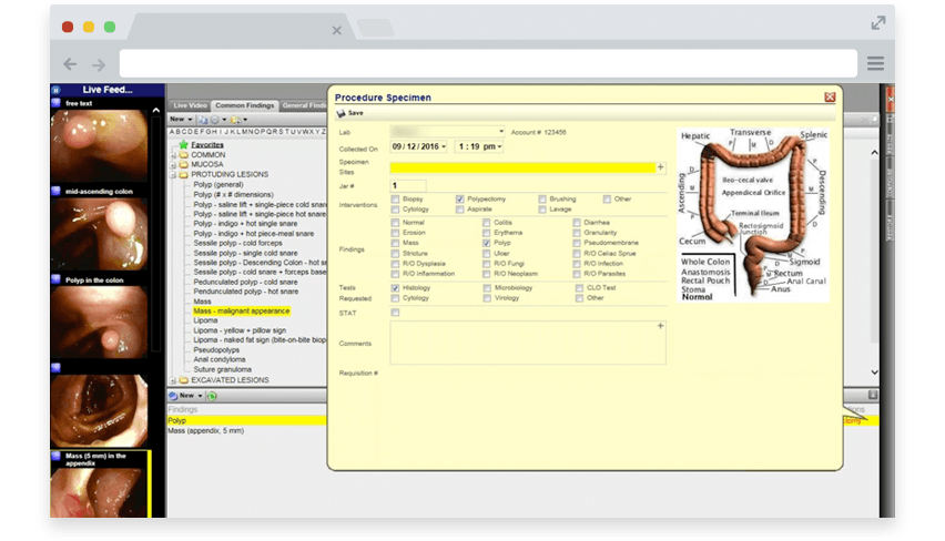 procedure specimen in endoscopy report writer software shown on desktop computer procedure specimen in endoscopy report writer software shown on desktop computer