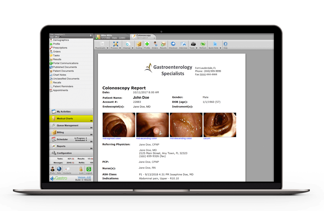colonoscopy report displayed on laptop computer colonoscopy report displayed on laptop computer