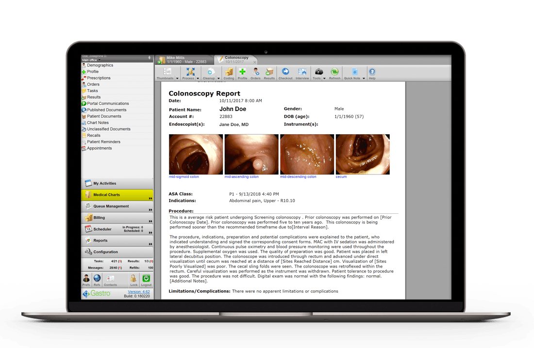 colonoscopy report displayed on laptop computer colonoscopy report displayed on laptop computer