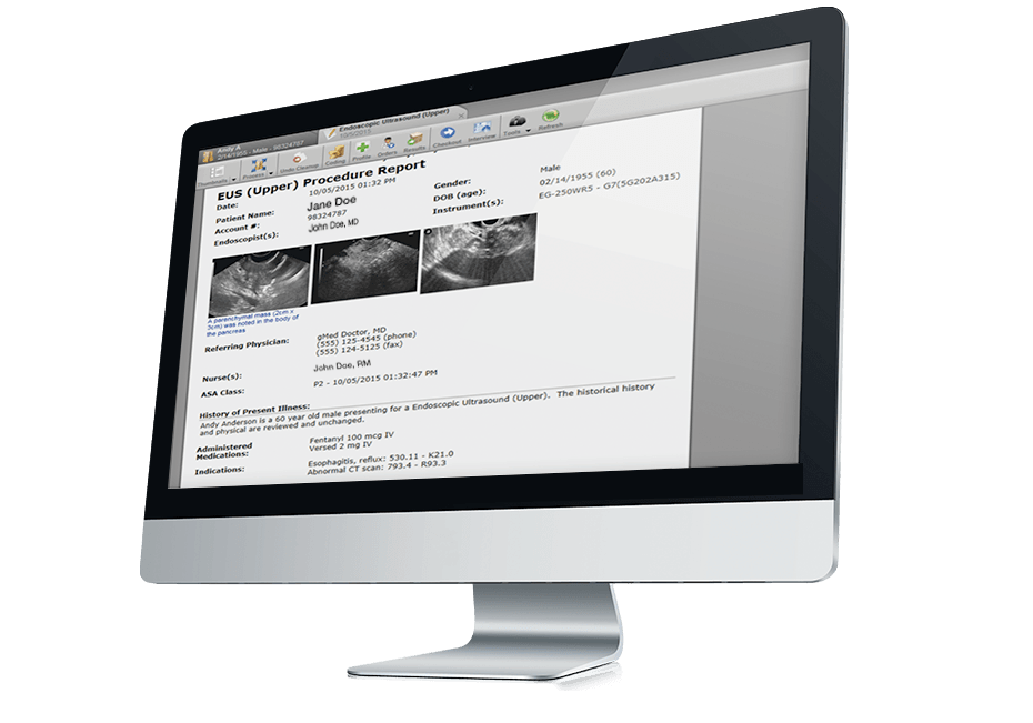 endoscopy report writer software on a desktop endoscopy report writer software on a desktop