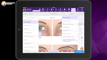 Transitioning to a new ophthalmology EHR system
