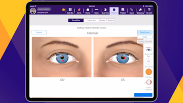 Documenting With a Smarter Ophthalmology EHR