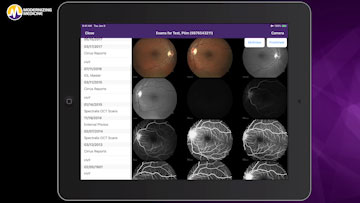 A Demo of Modernizing Medicine’s Retina Image Management System