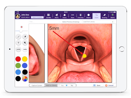 Drawing Board in EMA on iPad showing larynx
