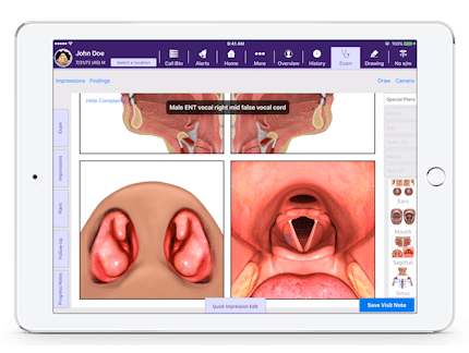 male ENT vocal right and mid false vocal chord 3d diagram in EMA Interactive Anatomical Atlas male ENT vocal right and mid false vocal chord 3d diagram in EMA Interactive Anatomical Atlas