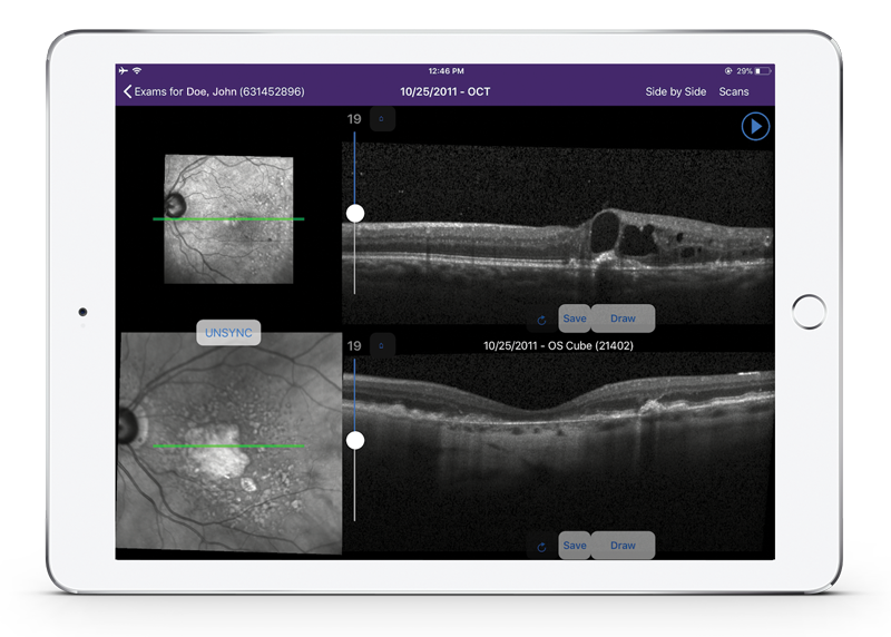 ophthalmology-image-management-oct-scan
