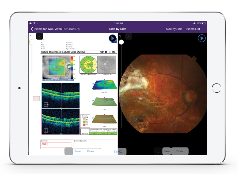 serial-comparison-in-ophthalmology-image-management-software