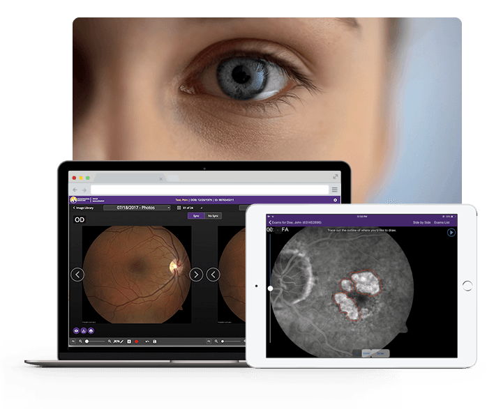 close up of eye behind ipad and laptop with eyeball x rays close up of eye behind ipad and laptop with eyeball x rays