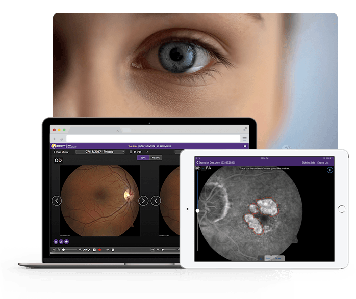 close up of eye behind ipad and laptop with eyeball x rays