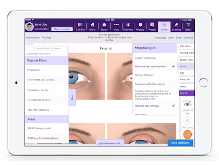 selecting plans and morphologies in EMA, an iPad-based ophthalmology EHR software selecting plans and morphologies in EMA, an iPad-based ophthalmology EHR software