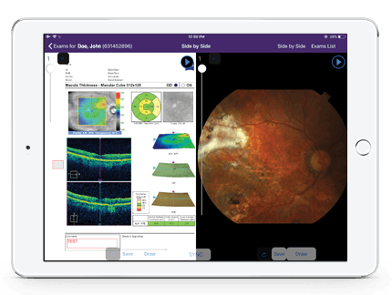 opening ophthalmic image management from patient chart