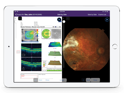 opening ophthalmic image management from patient chart opening ophthalmic image management from patient chart