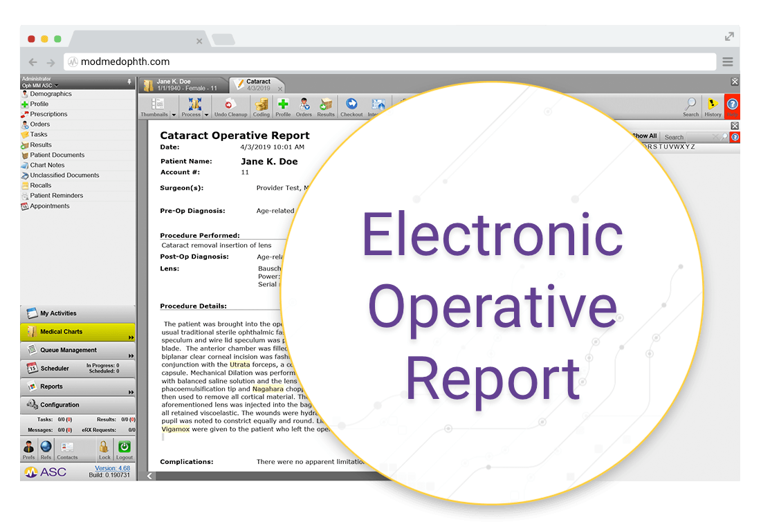 Cataract Operative Report in ModMed ASC electronic health records