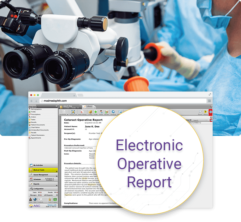 cataract operative report in ModMed ASC cataract operative report in ModMed ASC