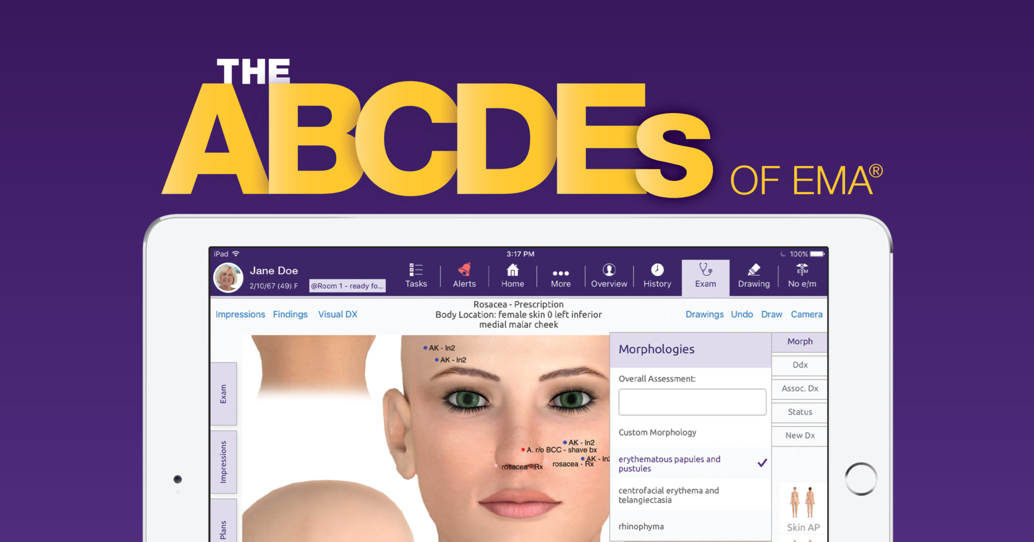 ipad-dermatology-ehr-with-abcde-text