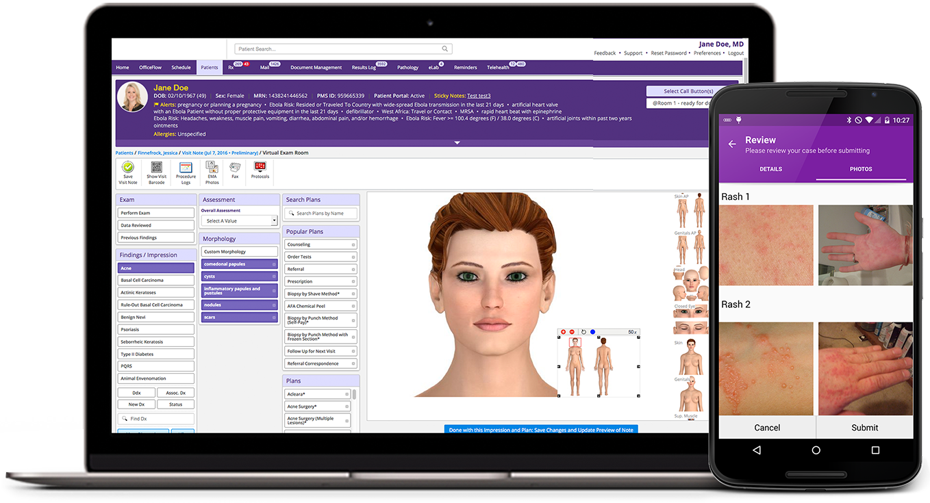 Laptop screen showing electronic health record