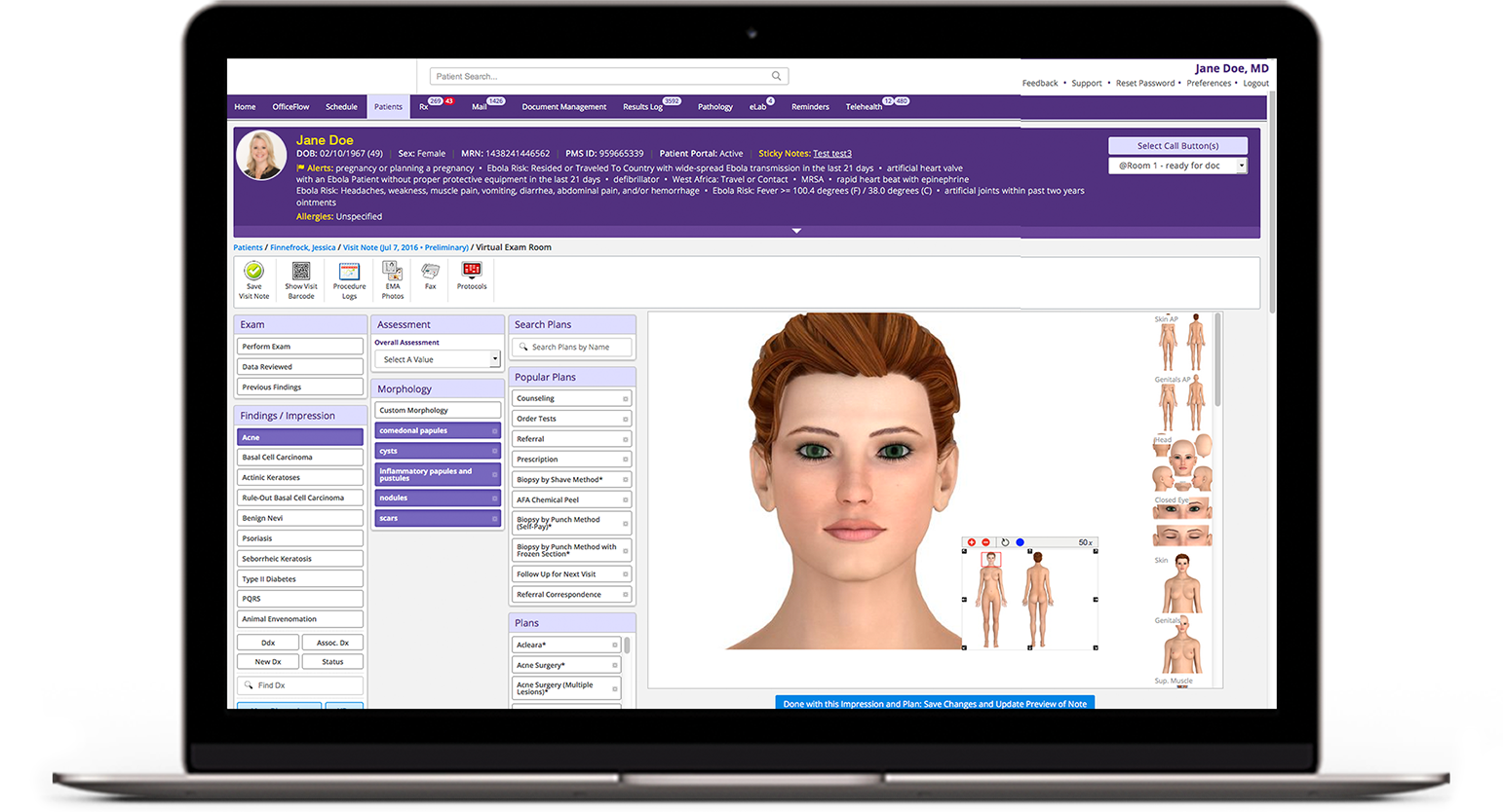 Laptop screen showing electronic health record