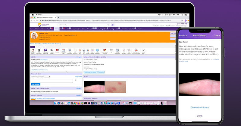 Computer screen and smartphone screen showing pictures of dermatology patient complaint