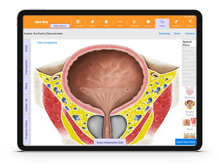 Urology-Specific EHR Anatomical Atlas