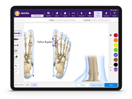 Screen with drawings on an image of foot bones