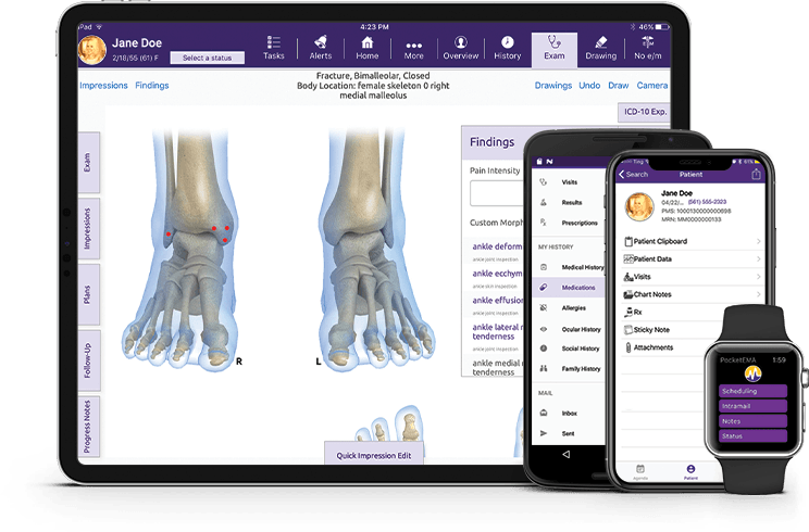 iPad, smart phones and Apple Watch displayng EMR iPad, smart phones and Apple Watch displayng EMR