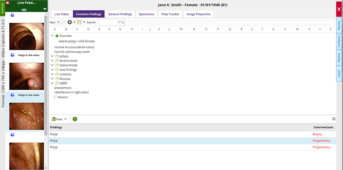 procedure note procedure note
