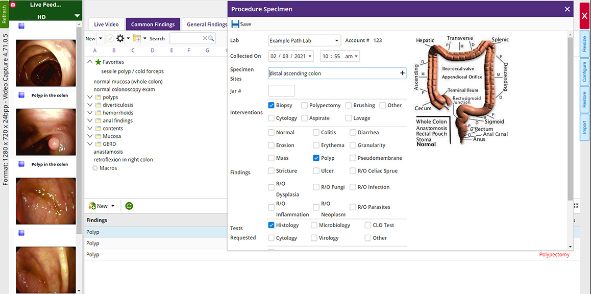 gastro procedure gastro procedure