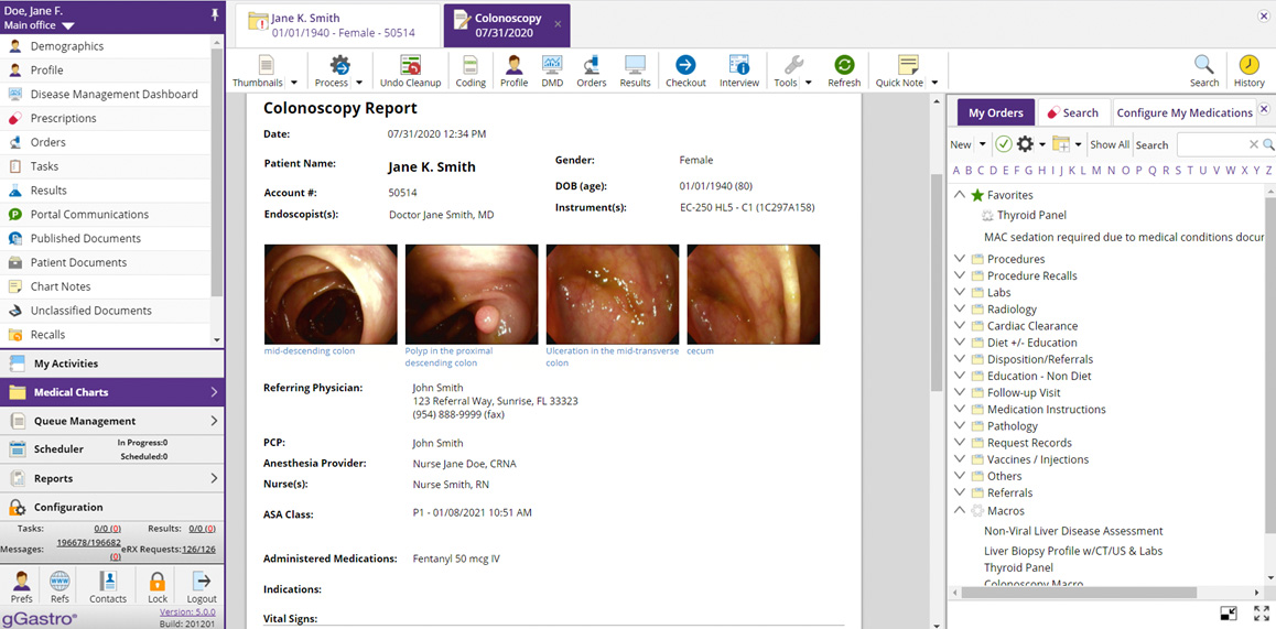 colonoscopy report